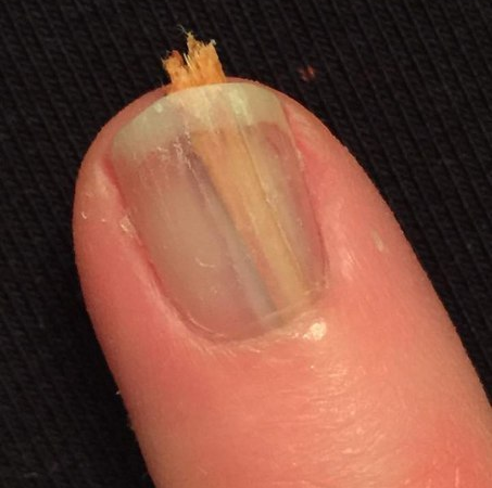 Kõige valusam veretu pilt