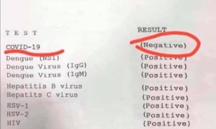 Jumal tänatud, mu koroonaviiruse test on negatiivne!